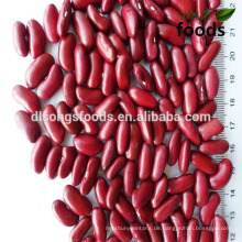 Preis für rote Linsen und Pflanzung roter Bohnen